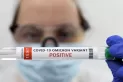 Cuáles son los síntomas de la subvariante Ómicron que ya es dominante en el mundo