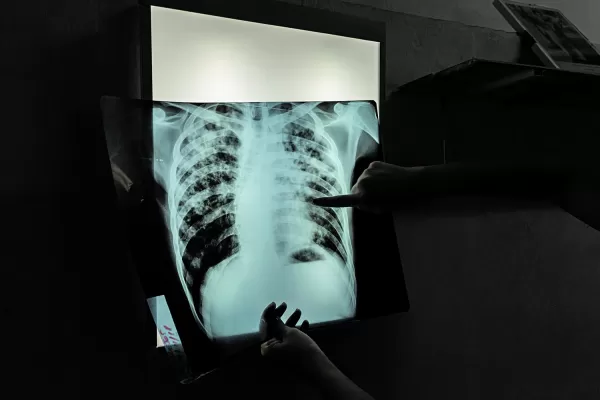 Renuncias masivas de médicos en el Ministerio de Salud nacional por desmantelamiento de programas esenciales