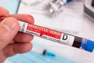 Murió un niño por una nueva hepatitis aguda: ¿cuáles son los síntomas?