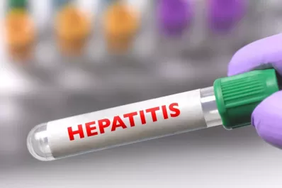 Panamá detectó el primer caso de hepatitis aguda infantil