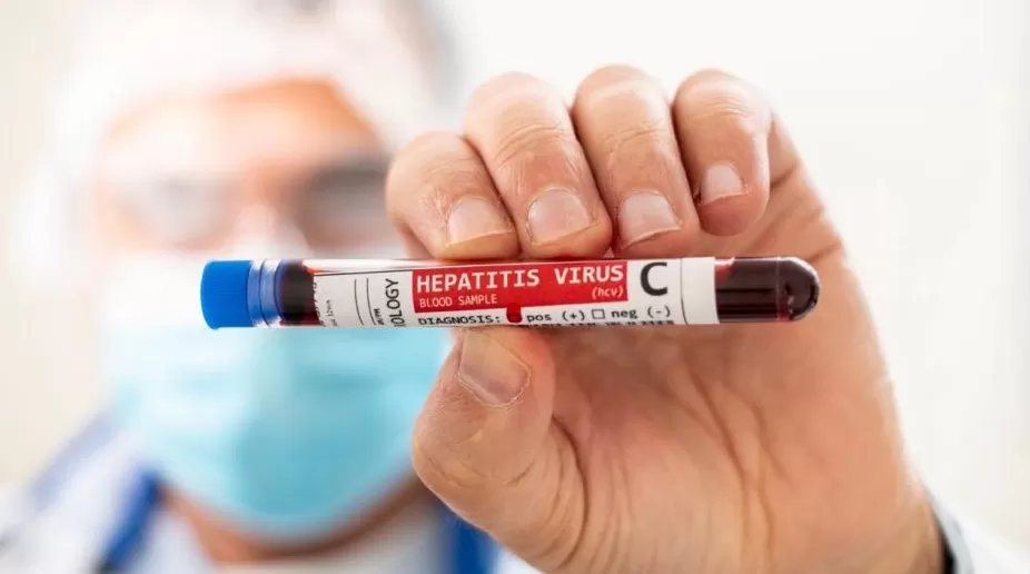 Estudian los orígenes de la hepatitis aguda