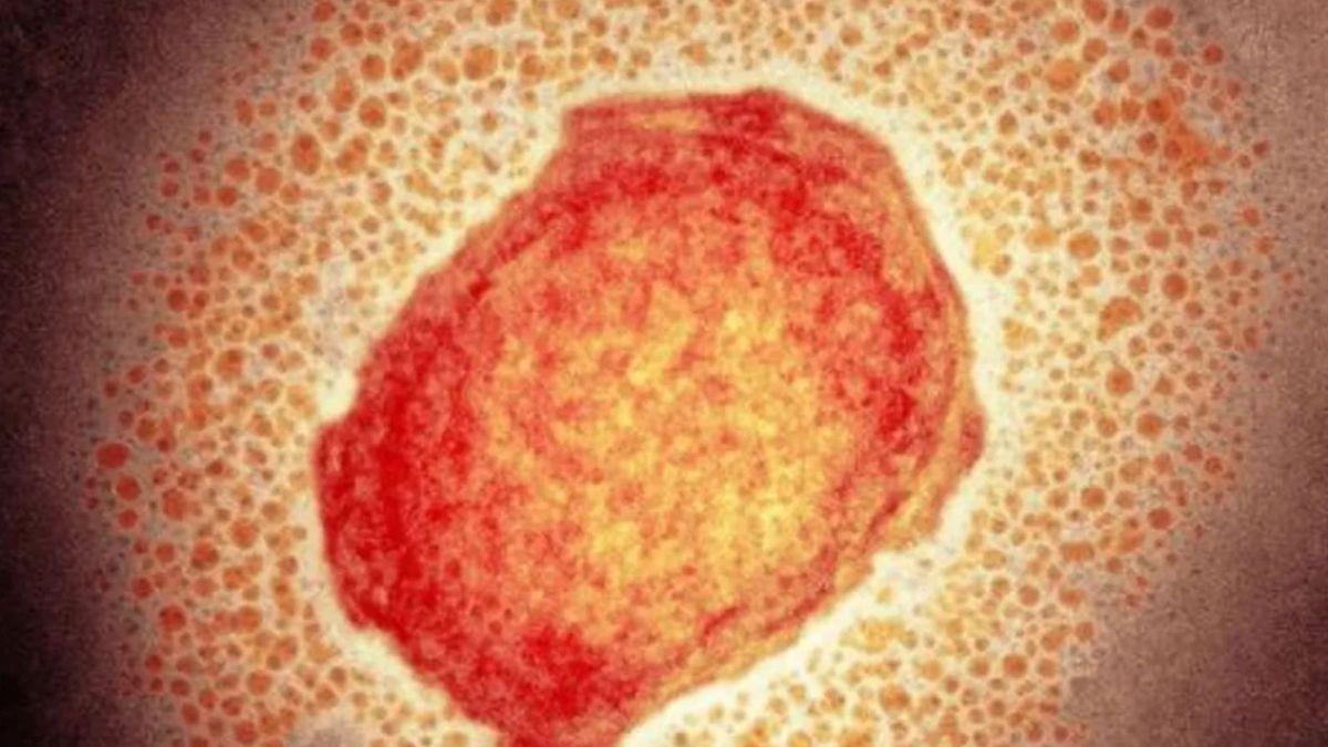 Una pequeña particula del virus de la viruela del mono.