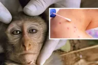 La viruela del mono se expande por más países de Europa