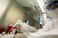 Existe una alta probabilidad de que el caso sospechoso sea viruela símica