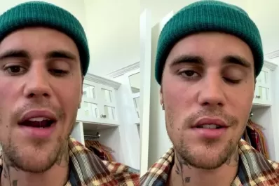 ¿Puedo tener la enfermedad de Justin Bieber?