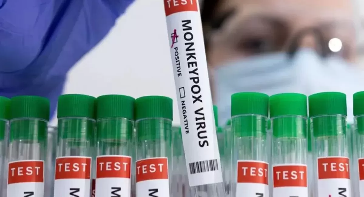 Nueva York declaró el estado de emergencia por la viruela símica