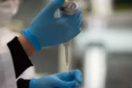 Contagios en Tucumán: Siempre que aparece un brote hay que investigarlo inmediatamente