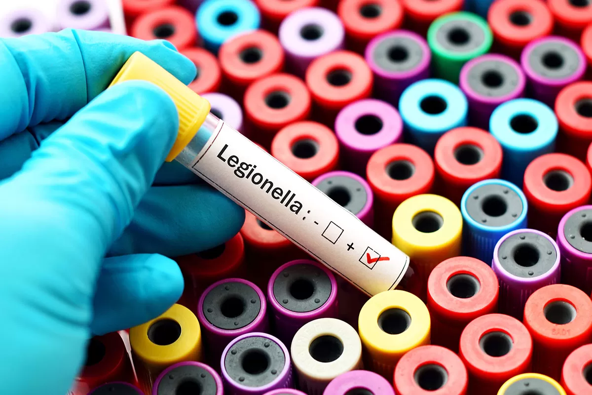 ¿Qué es la legionella?