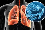 Legionella en Tucumán: tras la confirmación de los casos por Vizzotti, ¿de qué se trata esta enfermedad?