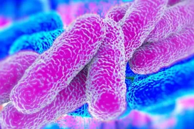 Cuándo se descubrió la legionella por primera vez y por qué lleva ese nombre