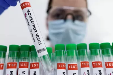 Viruela símica en Argentina: confirmaron 265 casos, un 20% más que la semana pasada