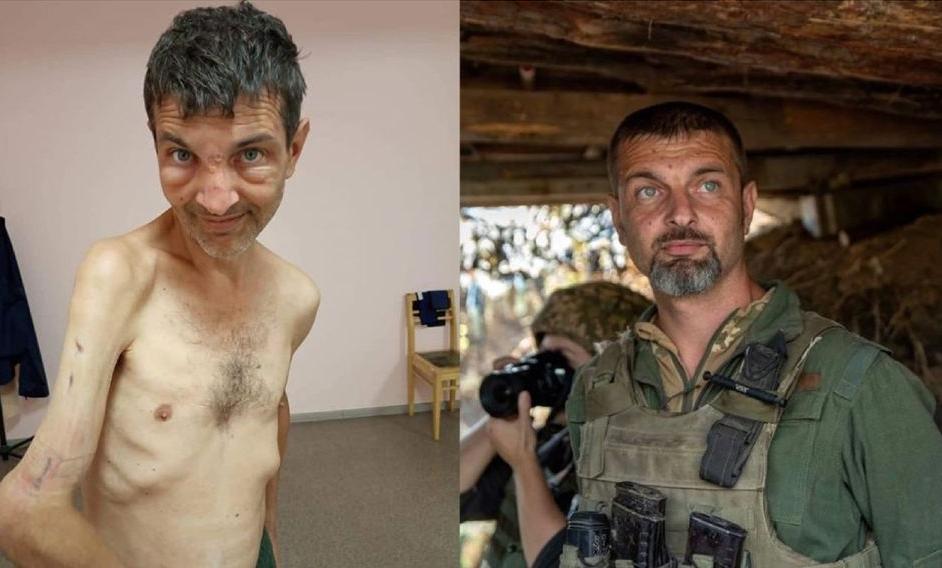 El antes y después del soldado ucraniano Mykhailo Dianov 