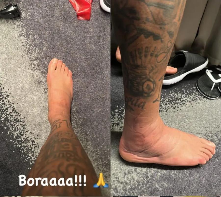 La impresionante imagen del tobillo de Neymar tras su lesión