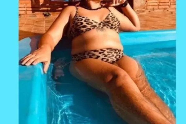 La belleza ¿debería doler?