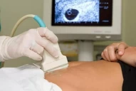 Tucumán es la segunda provincia con mayor tasa de abortos legales