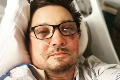 El actor Jeremy Renner compartió una nueva foto de su estado actual y reveló que se fracturó más de 30 huesos