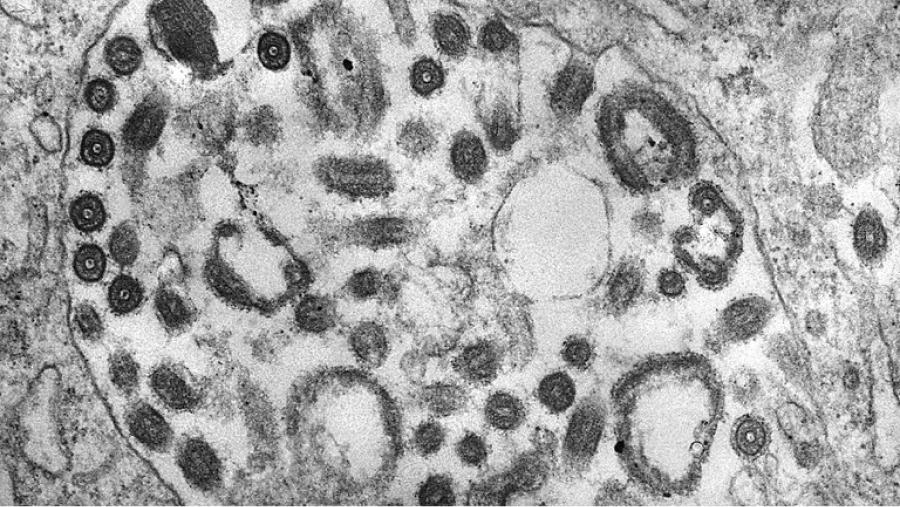 La enfermedad tiene un periodo de incubación de 2 a 21 días, según la OMS (Photo by Smith Collection/Gado/Getty Images).