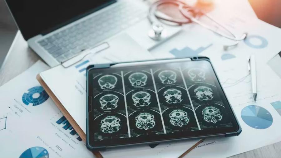 En el mundo están aumentando los casos de Alzheimer de inicio precoz (antes de los 65 años). Pero el caso del joven en China sería infrecuente/ (Getty)