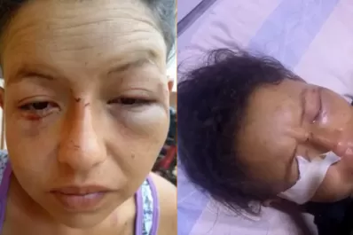 Acusó a una vecina de coquetear con su marido y la atacó a cuchillazos