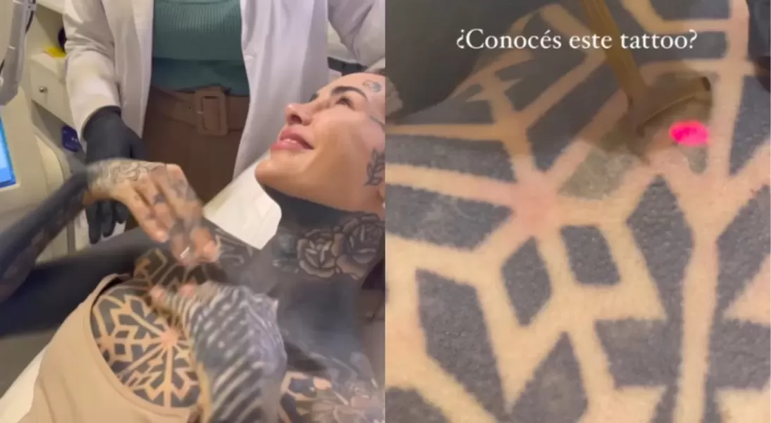 Cande Tinelli se sometió a un tratamiento para eliminar parte de su tatuaje en el tórax.