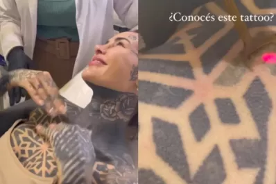 Candelaria Tinelli decidió borrar uno de sus tatuajes y sorprendió a sus seguidores con un cambio de look