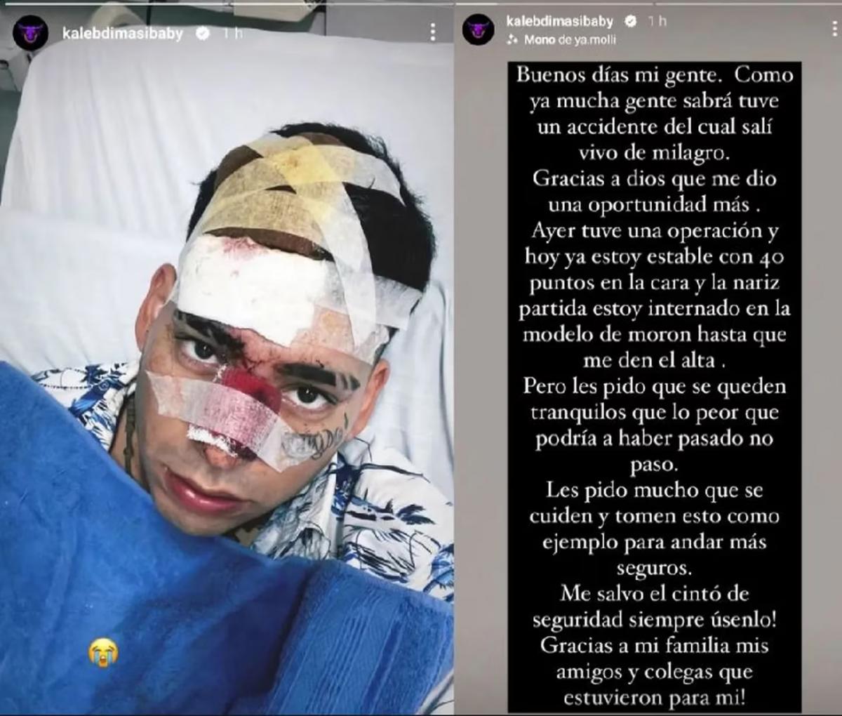 El cantante Kaleb Di Masi tuvo un gravísimo accidente automovilístico: “Estoy vivo de milagro”