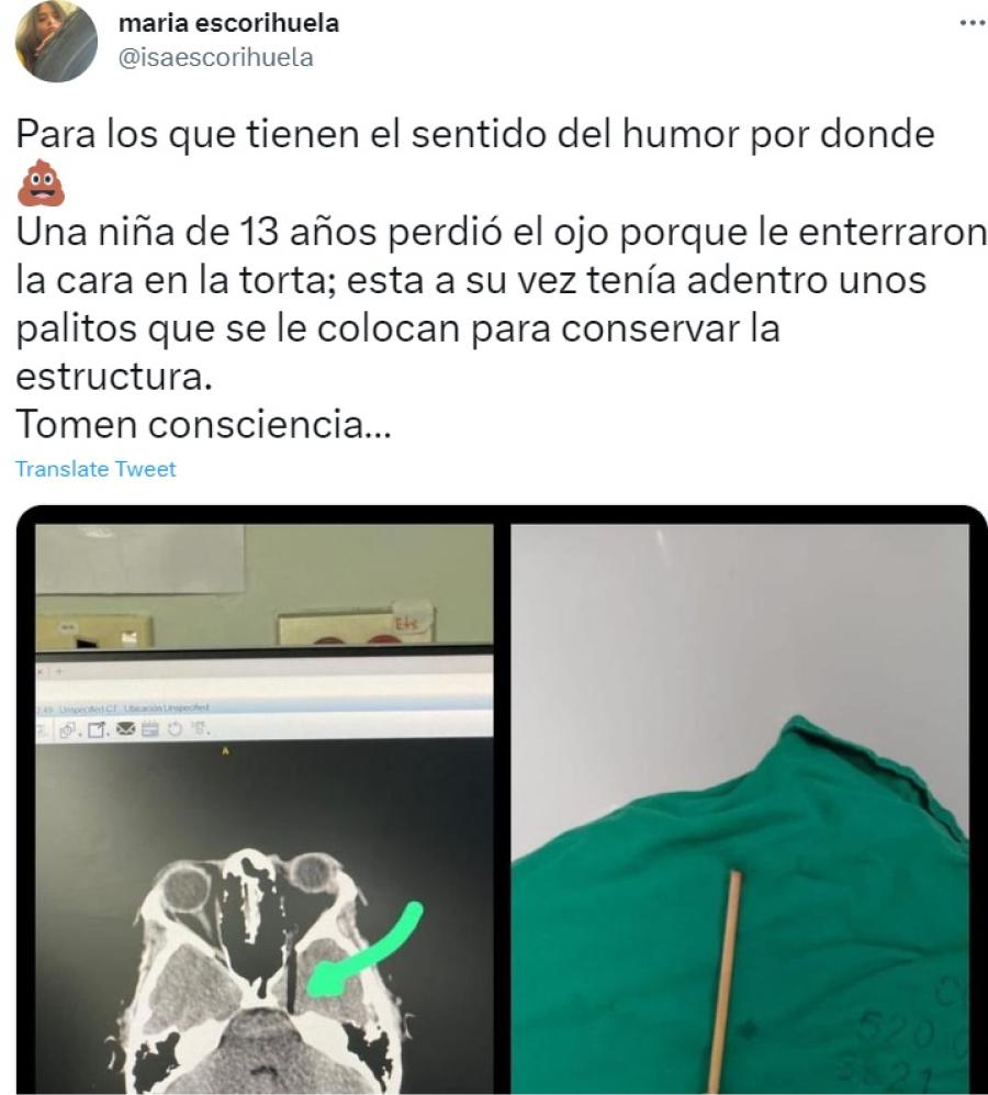 De la broma a la tragedia: una mujer casi pierde uno de sus ojos por el tradicional “tortazo” en su fiesta de cumpleaños