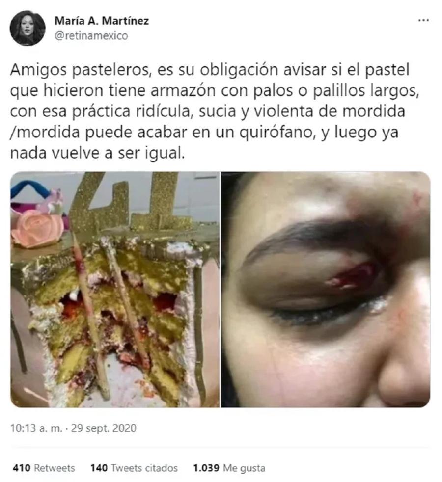 De la broma a la tragedia: una mujer casi pierde uno de sus ojos por el tradicional “tortazo” en su fiesta de cumpleaños