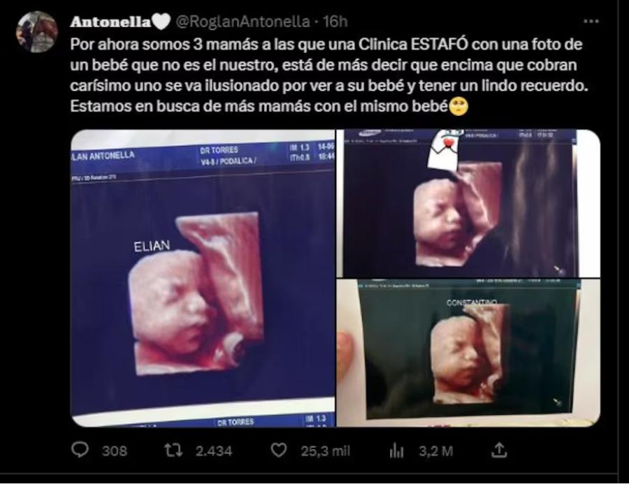 Estafa a madres: denuncian que una clínica utilizaba la misma ecografía para todas las embarazadas