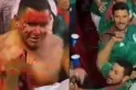 Terror en la Copa Oro: un hincha fue apuñalado en el cuello durante partido entre México y Qatar