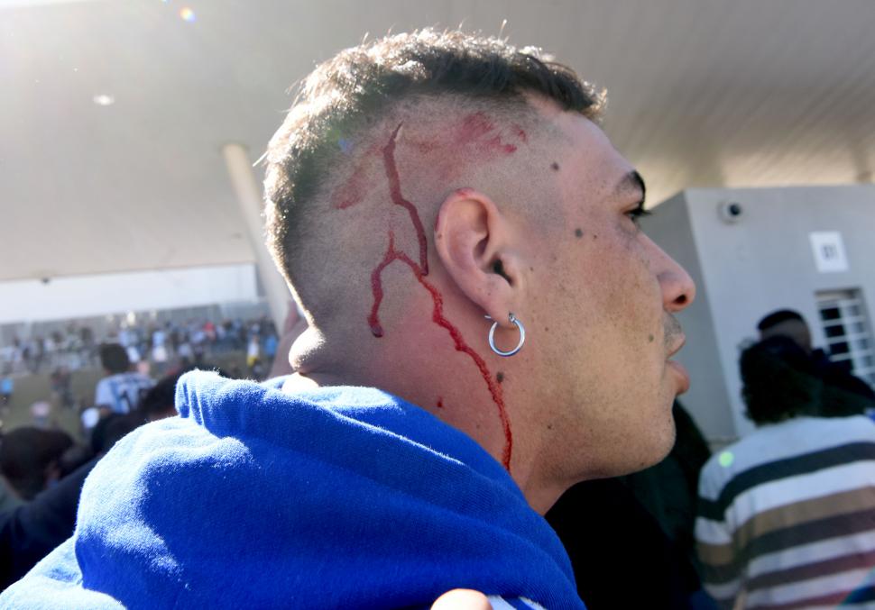 HERIDAS EN LA CABEZA. Muchos hinchas tucumanos fueron reprimidos.  