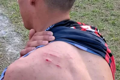Incidente en la Liga: “Temí por mi vida”, dijo el jugador agredido