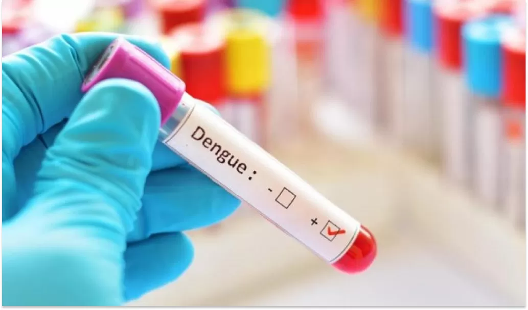 Argentina se prepara para la llegada del inoculante en medio de la epidemia de dengue