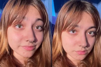 Se cansó de que le pregunten qué tienen sus ojos: “Es congénito, nadie de mi familia lo tiene”