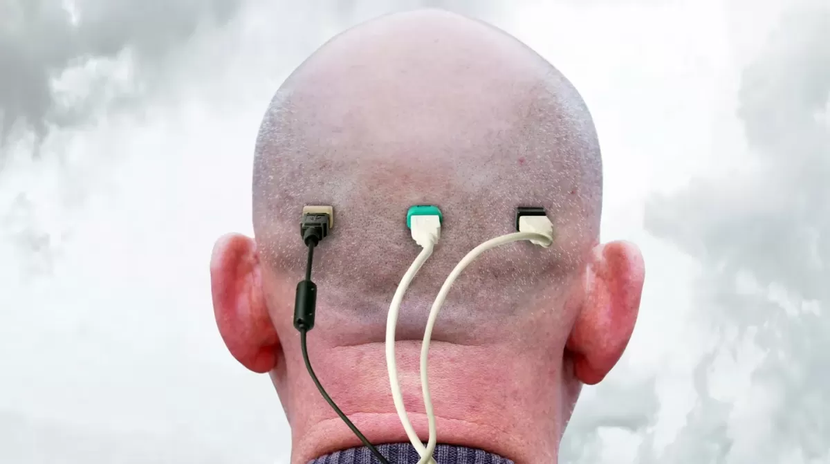 Neuralink busca voluntarios para probar sus implantes cerebrales. 