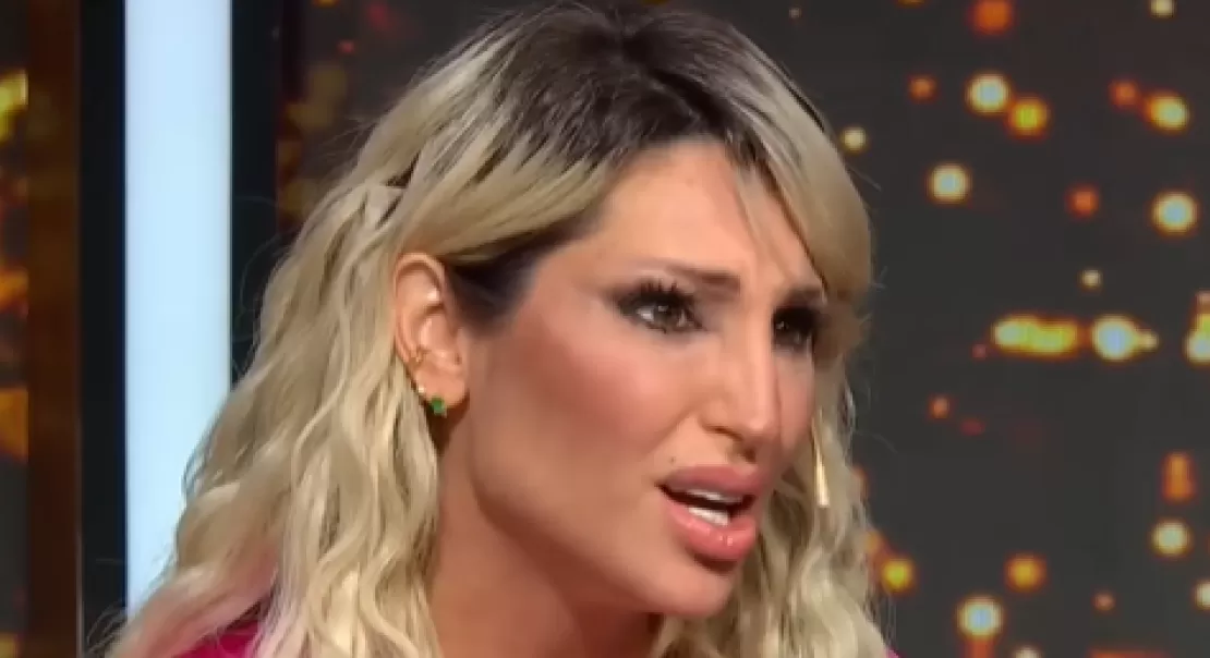 Vicky Xipolitakis contó que tras su operación con Lotocki se encontró con “cosas que no había pedido”