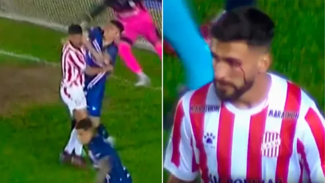 Video: la brutal trompada del jugador de Deportivo Morón que le cortó el párpado a Emanuel Dening