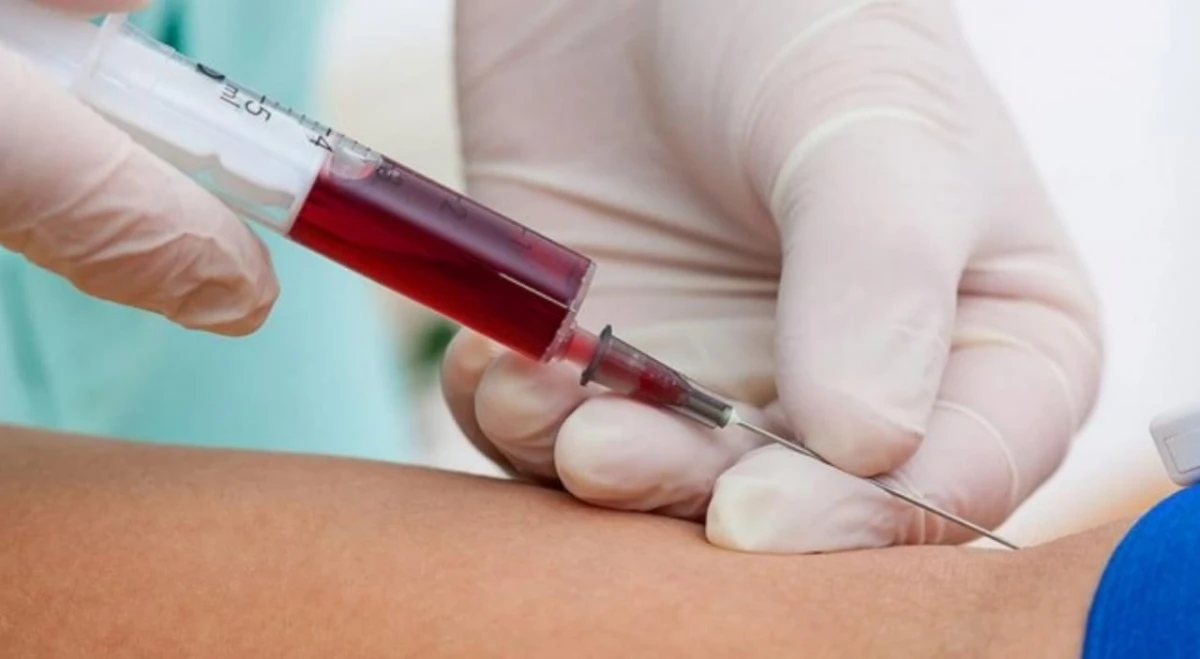 Enfermedad de Gaucher, un trastorno poco común, que se diagnostica gratis