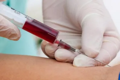 Enfermedad de Gaucher, un trastorno poco común, que se diagnostica gratis