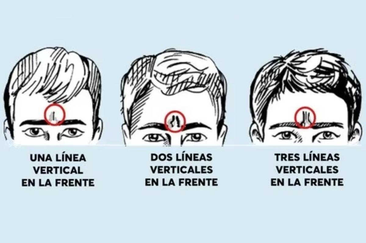 Test viral: ¿qué revelan las líneas de tu frente sobre personalidad?