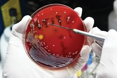 La resistencia a los antimicrobianos, entre las 10 principales amenazas a la salud