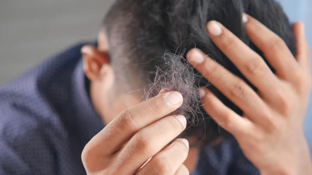 ¿Cuáles son las vitaminas esenciales para evitar la caída de cabello?