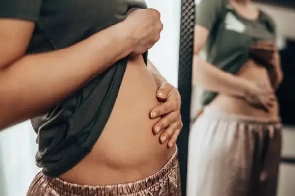 ¿Te sentís hinchado?: la mejor infusión para desinflamar la abdomen rápidamente