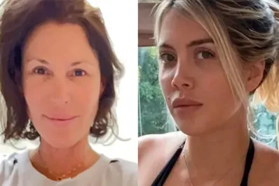 Wanda Nara y Celina Rucci enfrentan una enfermedad similar: ¿cuál es la diferencia?