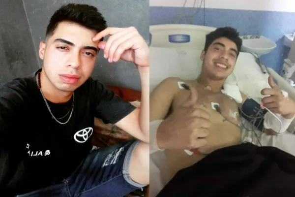 Qué dijo el joven que sobrevivió a un rayo y se quemó el 70% del cuerpo