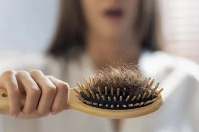 Alopecia: qué vitaminas hay que consumir para evitar la caída del cabello