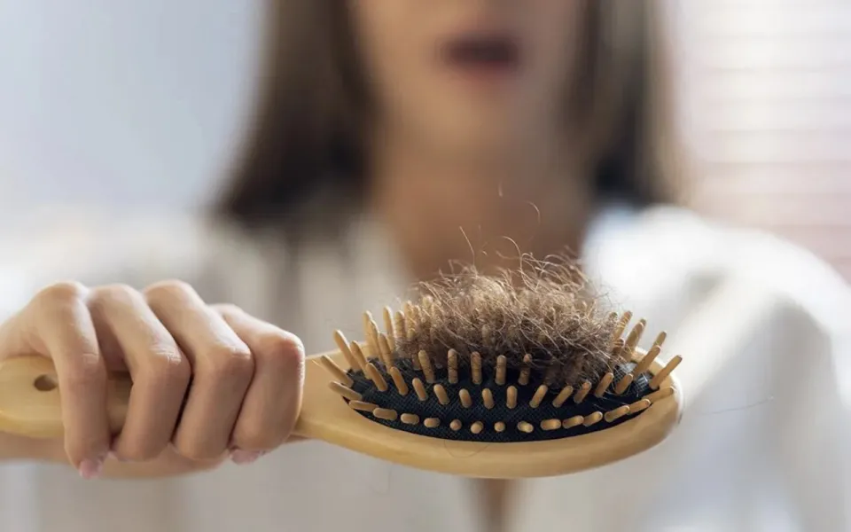 Alopecia: qué vitaminas hay que consumir para evitar la caída del cabello