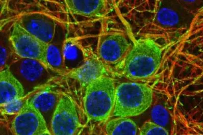 Científicos del Conicet revelan estudios terapéuticos para el parkinson y alzheimer