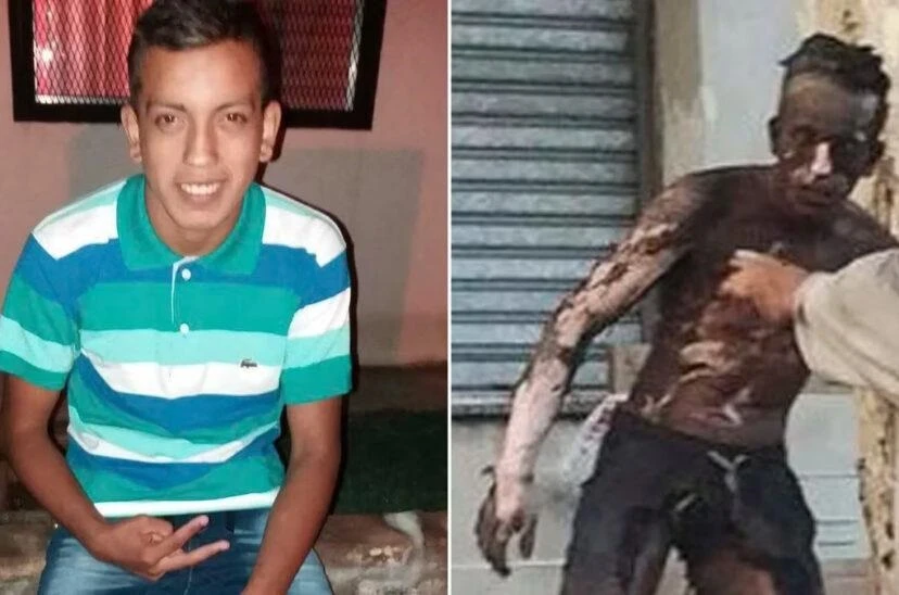 DIFERENCIA. El joven rosarino que murió después de sufrir quemaduras.