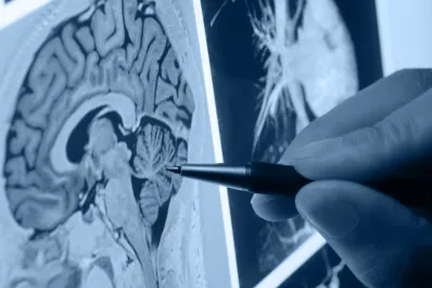 Alzheimer: ¿tiene incidencia la hormona de crecimiento?